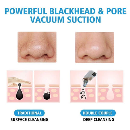 Pore Cleaning Device